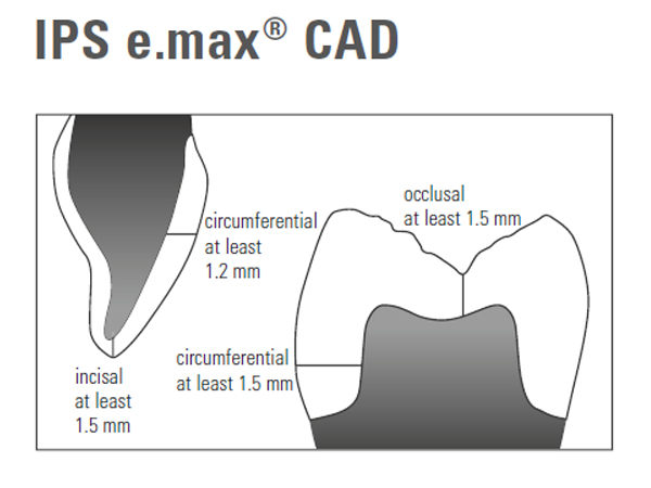 Emax Cad Firing Chart