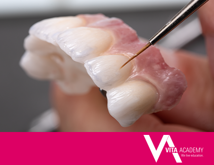 Altersgerechte &Auml;sthetik mit VITA LUMEX UNIQUE auf monolithischem Zirkon