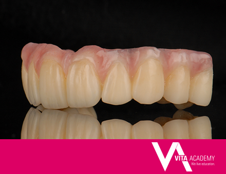 VITA VIONIC DENT DISC multiColor