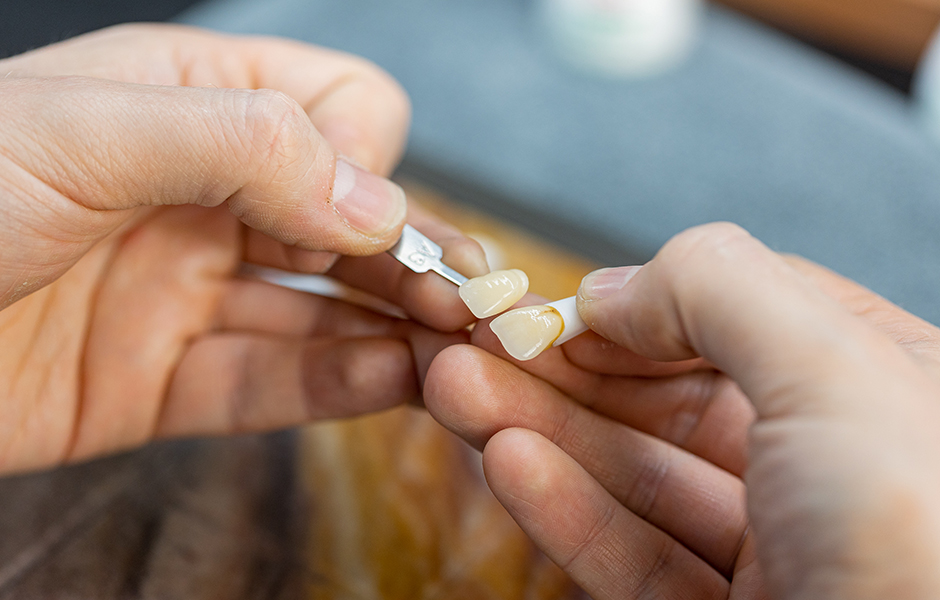 Protésica dental maquillando restauraciones de VITA AMBRIA