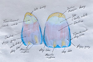 In the dental office, the basic tooth shade was determined and a layer sketch was made.