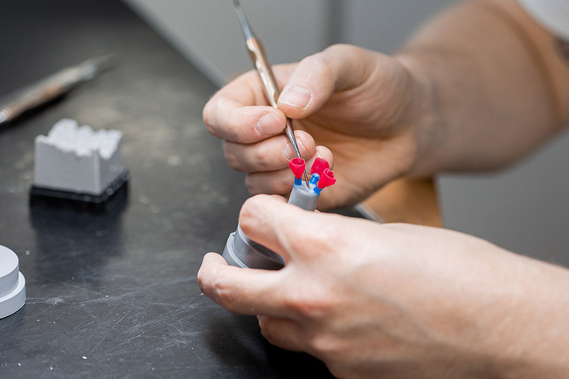 Modeling of crowns in wax