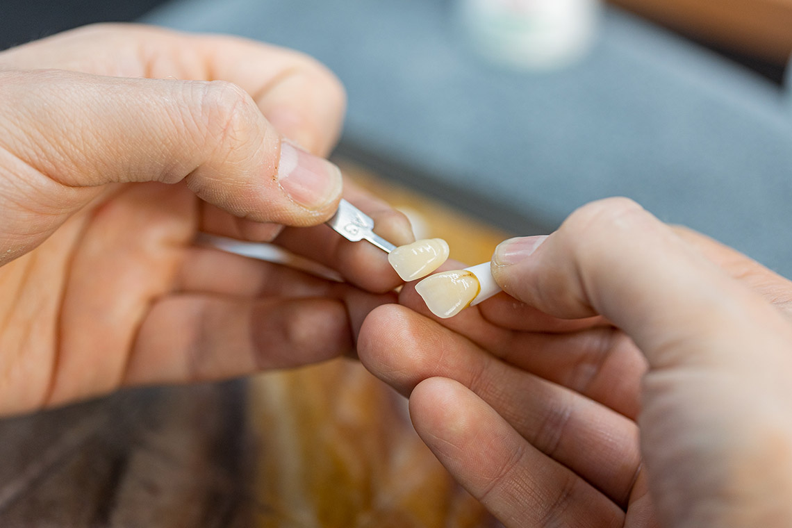 Controllo della fedeltà cromatica di una corona in ceramica pressabile VITA AMBRIA con campione colore