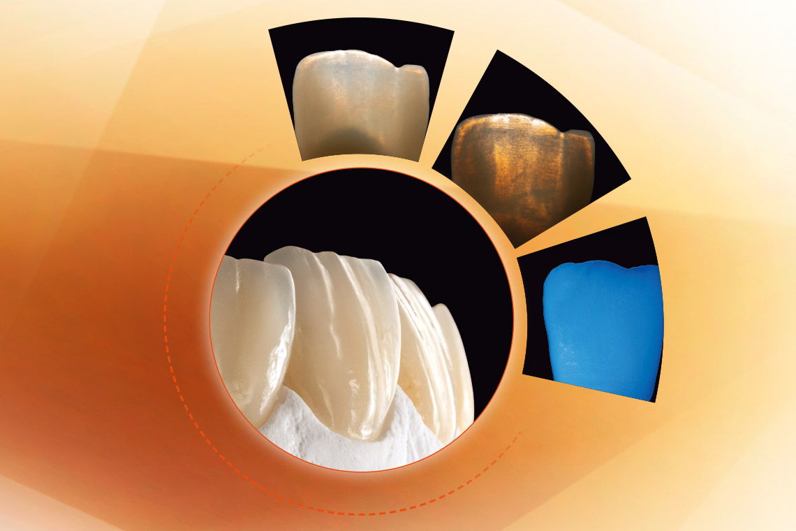 Anterior tooth crowns made of VITA Press Ceramic, plus photos of its photo-optical properties