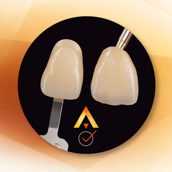 Checking the correct tooth shade of a press ceramic crown using a shade sample