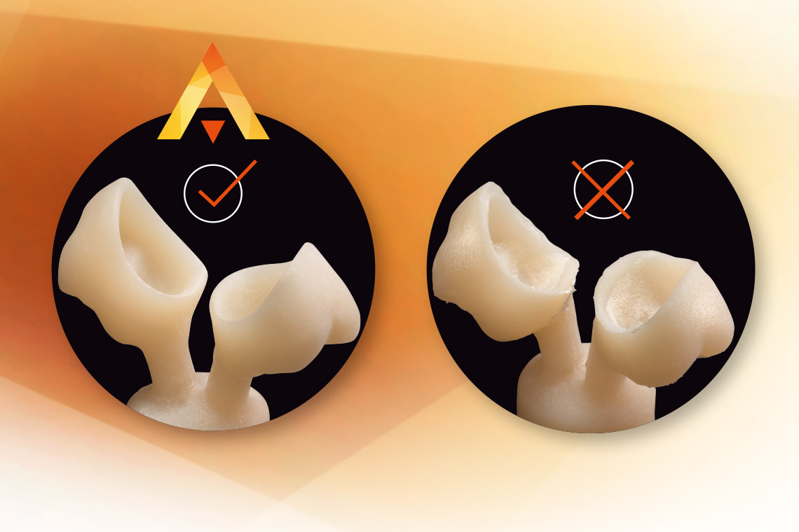 Crowns made of press ceramic with and without reaction layer