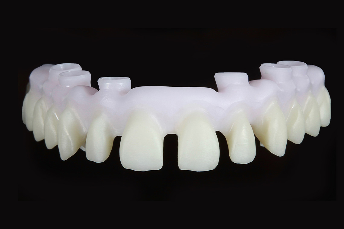 Initial situation: The stained zirconia substructure made of VITA YZ HT after sintering.