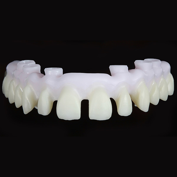 The stained zirconia substructure made of VITA YZ HT after sintering.