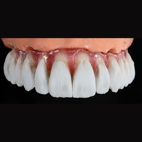 Stratificazione alternata del bordo incisale con ENAMEL clear, fog e OPAL TRANSLUCENT opal-neutral.