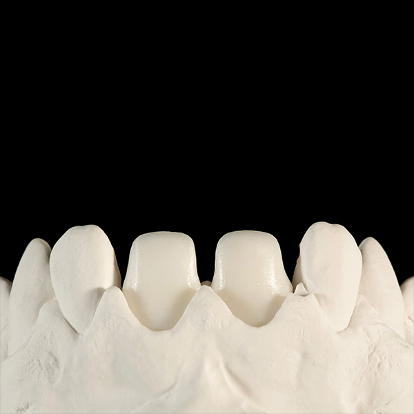 Le strutture realizzate con tecnologia CAD/CAM in biossido di zirconio VITA YZ HT White.