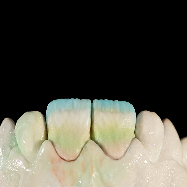 Directly under the incisal area, a white stripe was added using TRANSLUCENT smoky white.