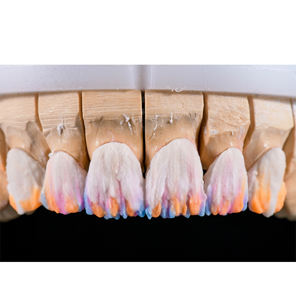 VITA LUMEX AC OPAQUE DENTINE A3,5 y A3, DENTINE A3 y A2, y MAMELON saffron.