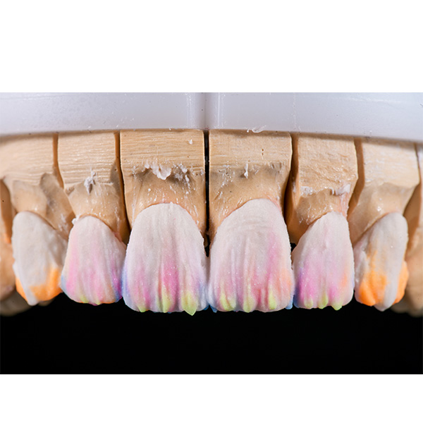 The enamel was layered with TRANSLUCENT, OPAL TRANSLUCENT, ENAMEL light and clear.