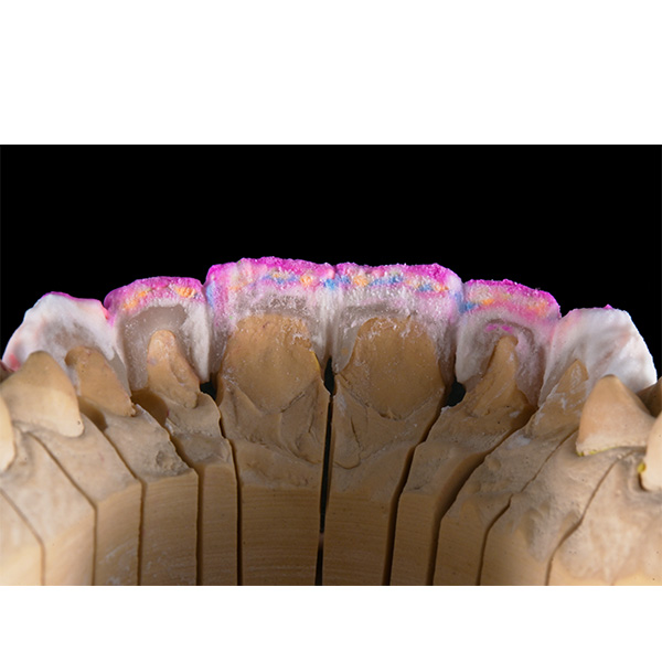 La stratificazione meticolosa nella vista palatina.