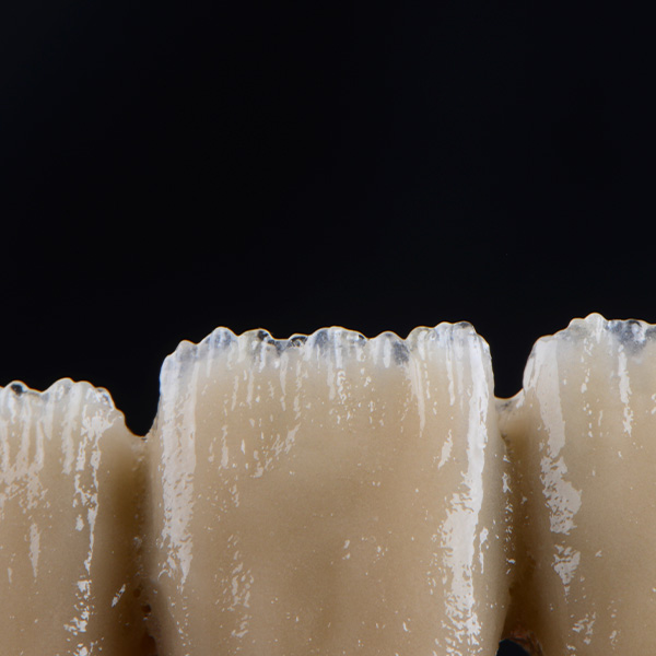 The veneering ceramic system offers all facets to enable natural reproduction of the hard tooth substance.