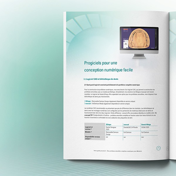 Aperçu dans le guide « Prothèse amovible numérique pour débutant »