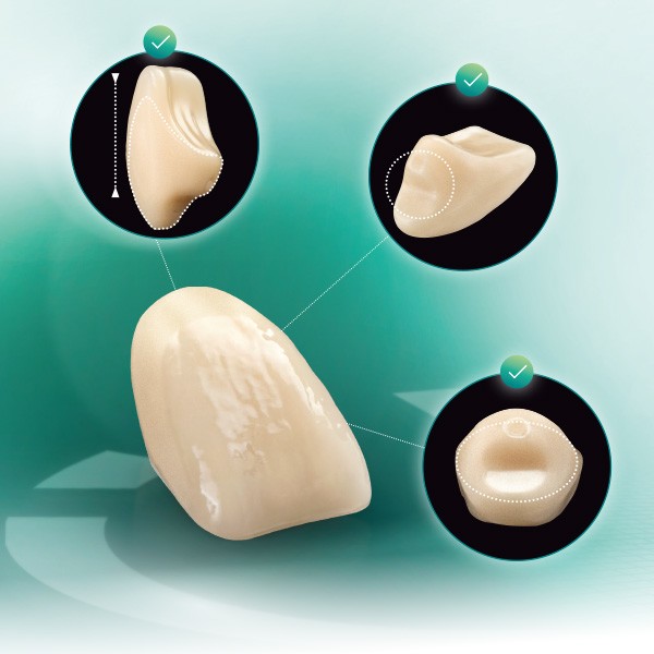 VITA VIONIC VIGO tooth from different perspectives