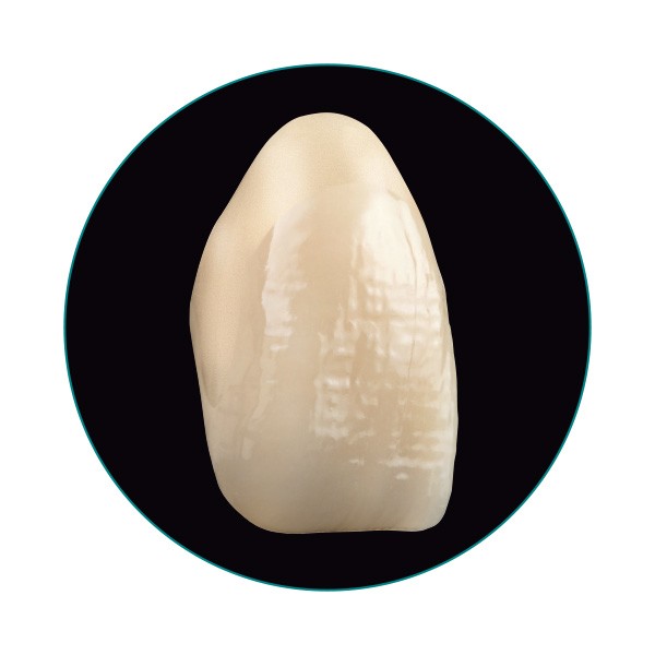VITA VIONIC VIGO tooth – lateral perspective