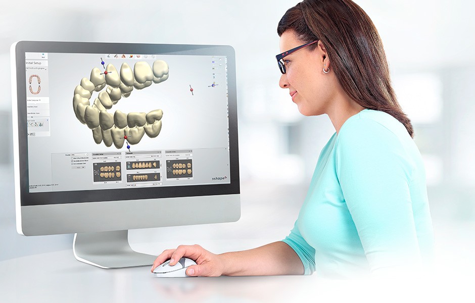 L'odontotecnica realizza la protesi nel sistema CAD, sullo schermo viene adattata la posizione di un dente