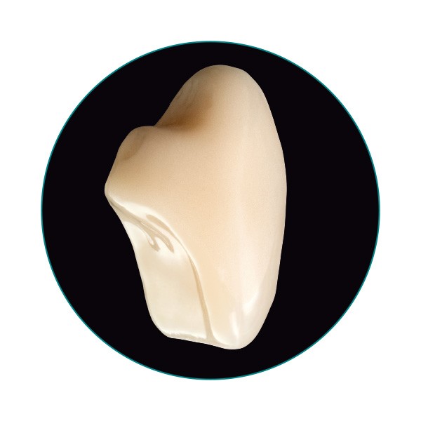 Vista posterior ligeramente oblicua del diente VITA VIONIC VIGO.