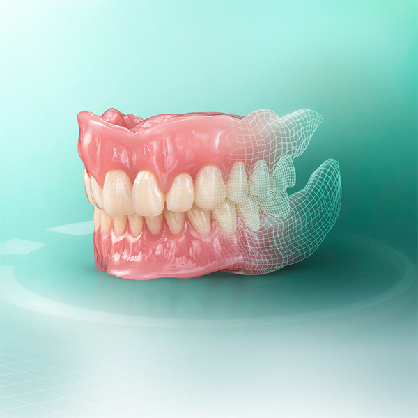 Digital gefertigte Zahnprothese aus VITA VIONIC Material Digital gefertigte Zahnprothese aus VITA VIONIC Material
