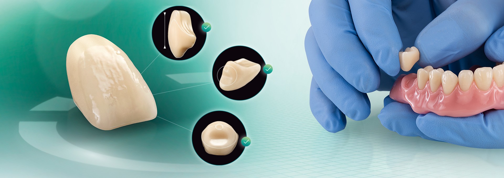 Der VITA VIONIC VIGO Zahn aus verschiedenen Perspektiven und in einer digital hergestellten Prothesenbasis