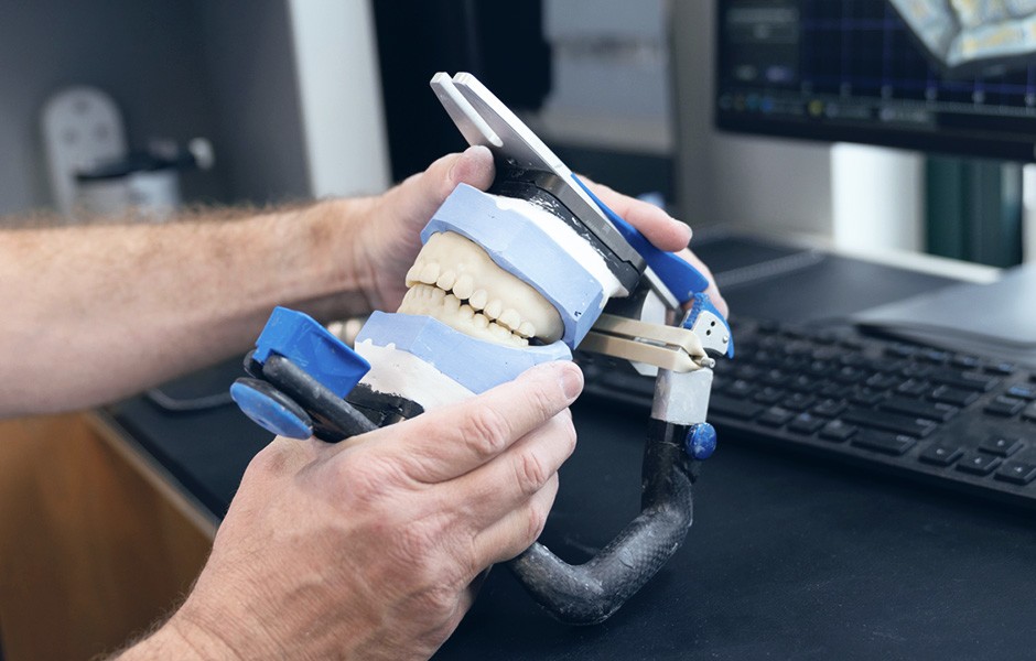 Prótesis superior e inferior para la prueba en modelos en un articulador.