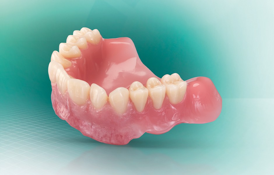 A digitally fabricated denture made of VITA VIONIC system components
