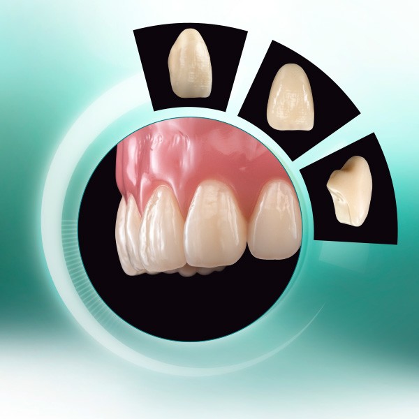 The denture tooth VITA VIONIC VIGO from different perspectives and in the denture