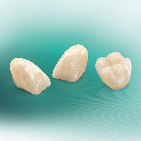 3 VITA VIONIC VIGO teeth