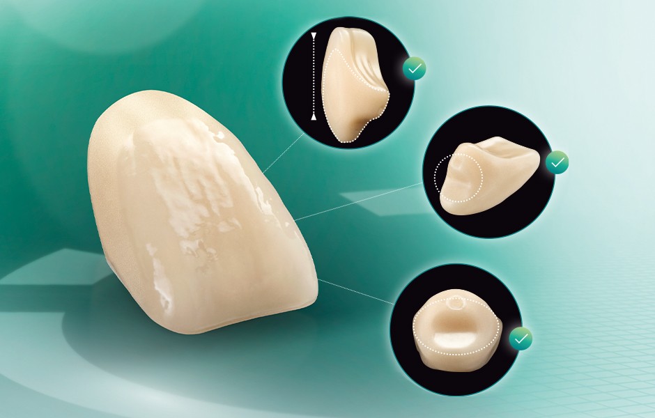 El diente protésico VITA VIONIC VIGO desde distintas perspectivas.