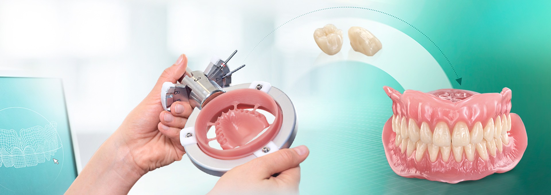 Gefräste Prothesenbasis und eine komplette digital hergestellte Prothese aus VITA VIONIC Material