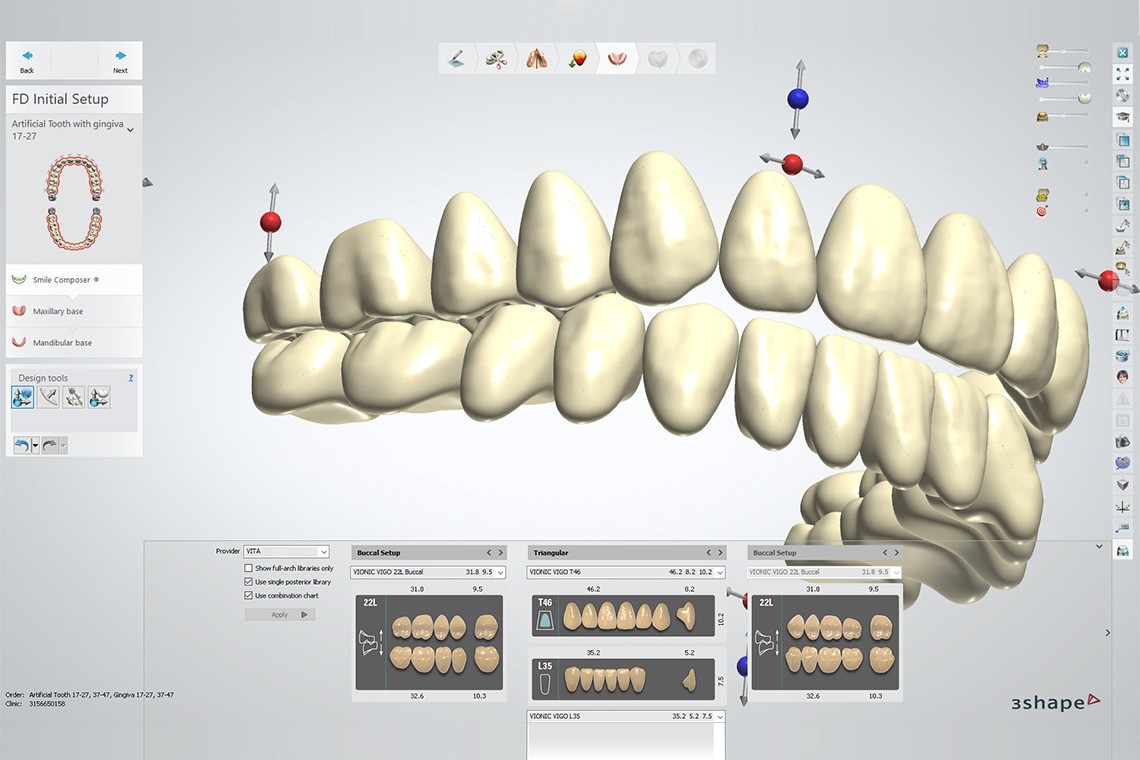 Vier Screenshots der 3Shape-Software mit einigen der vielen  Aufstellungen aus der VITA Bibliothek
