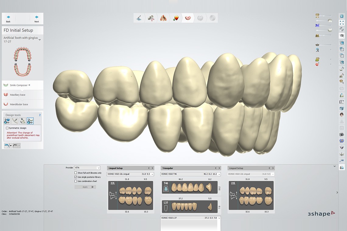 Vier Screenshots der 3Shape-Software mit einigen der vielen  Aufstellungen aus der VITA Bibliothek