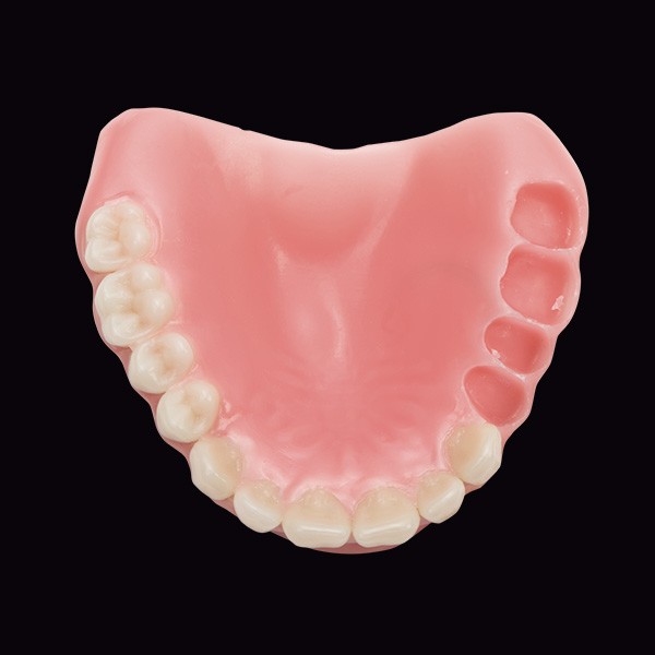 Milled wax base for try-in with VITA VIONIC VIGO teeth