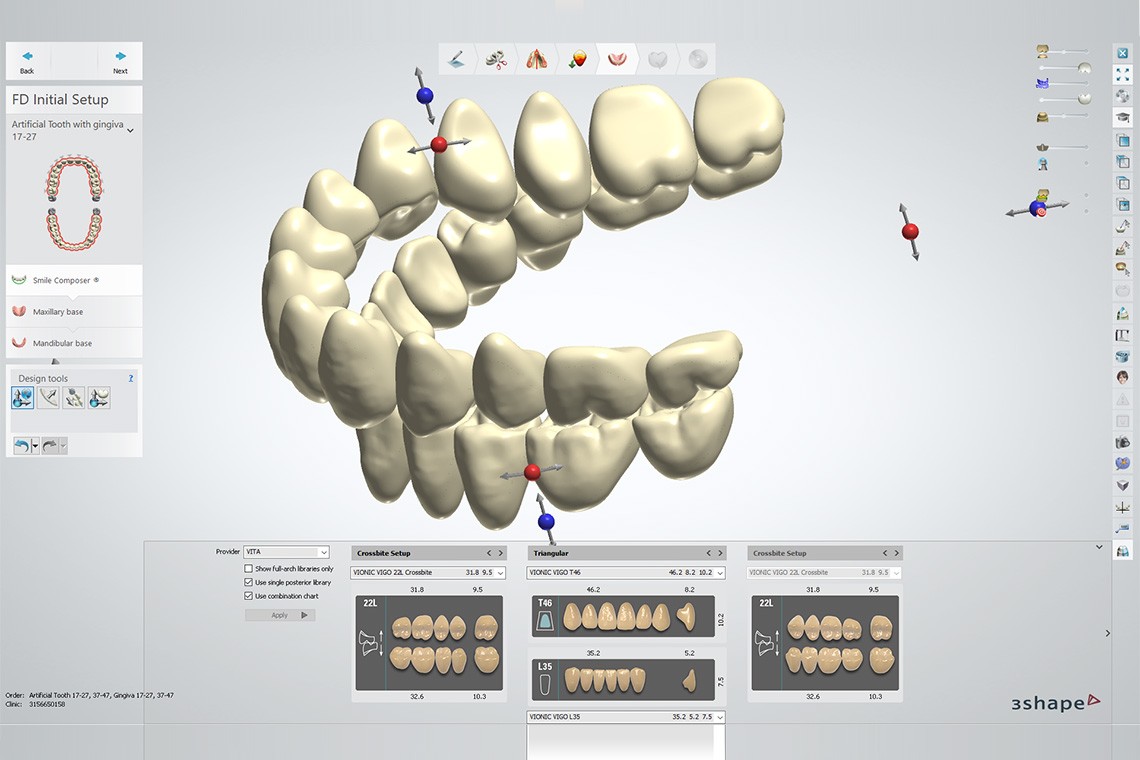 Quatre captures d'écran du logiciel 3Shape avec quelques-uns des nombreux montages provenant de la bibliothèque VITA