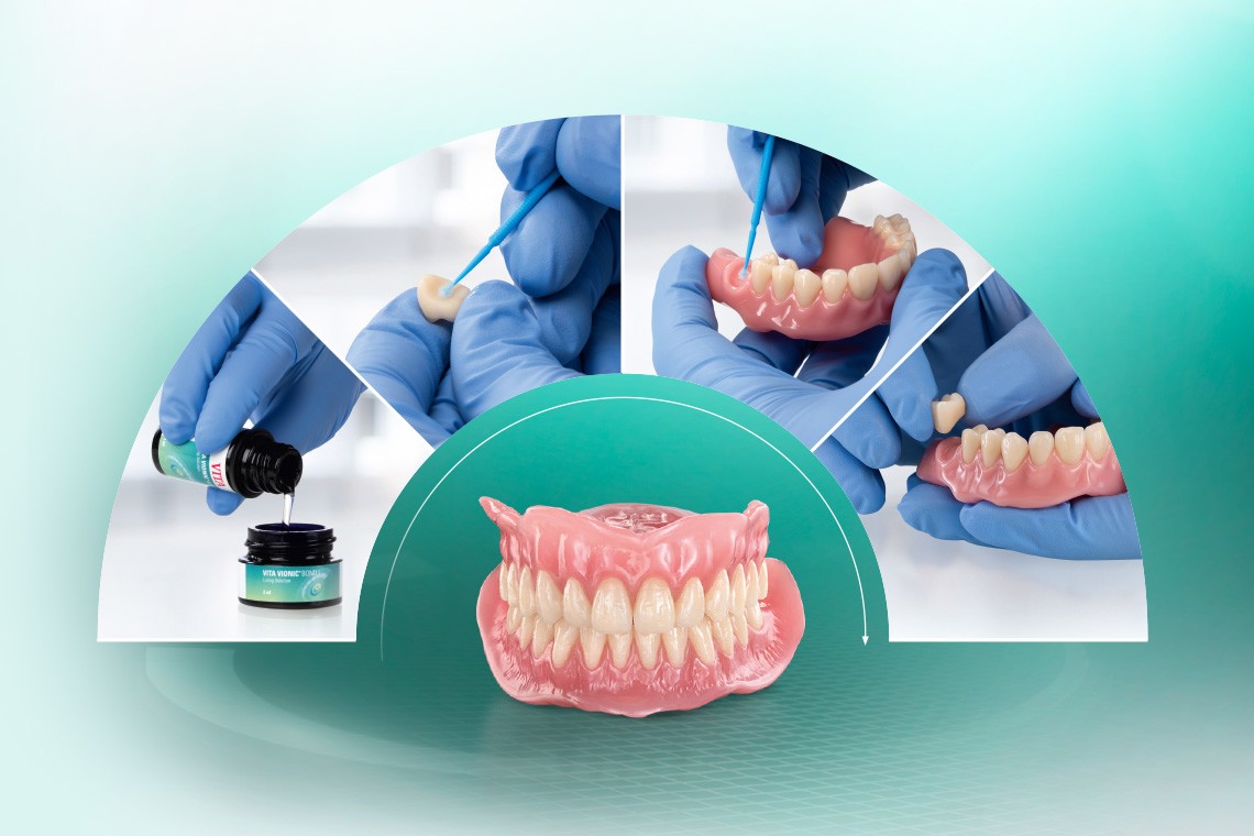 Processo di incollaggio di denti protesici prefabbricati VITA VIONIC VIGO