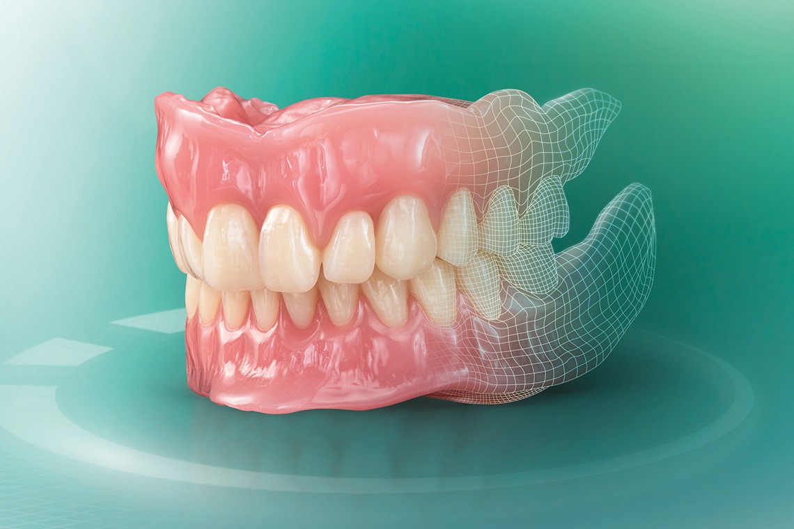 Prótesis dental de material VITA VIONIC confeccionada digitalmente.