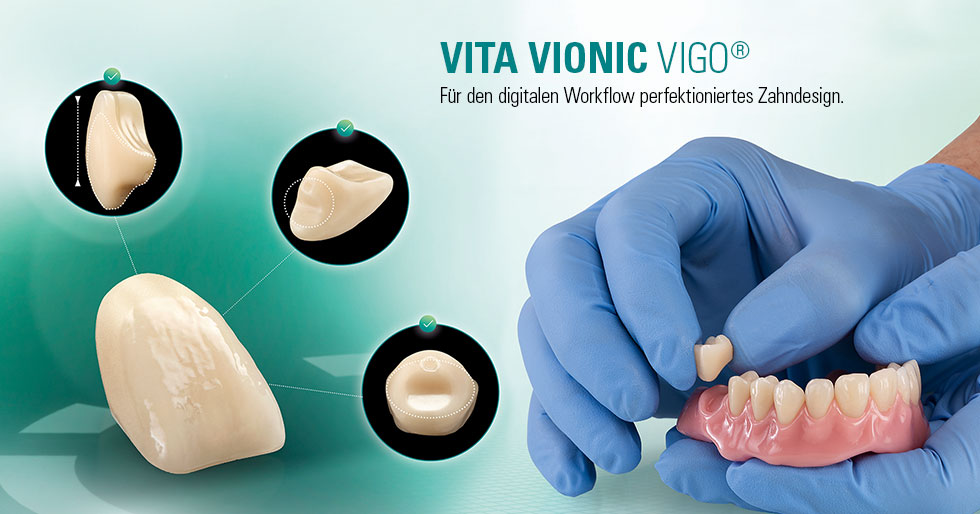 VITA VIONIC VIGO®. Totalprothesen mit digitalem Fertigungssystem