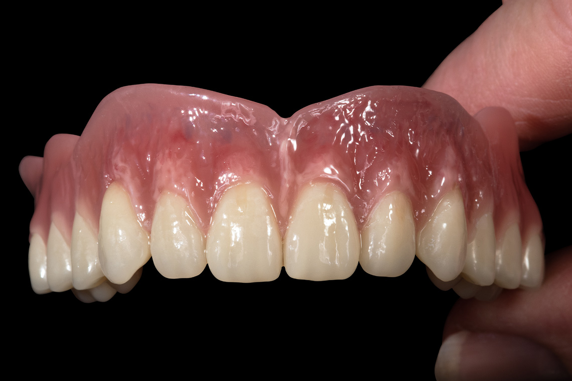 The result after final curing of the complete characterization in the polymerization device.