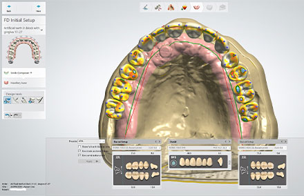 Checking the occlusal contacts and the freedom in centric.