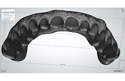 The STL file of the dental arch for the denture.