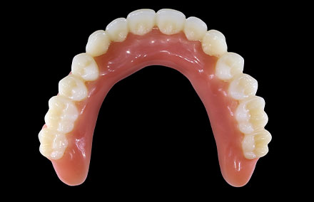 The completed digital denture.