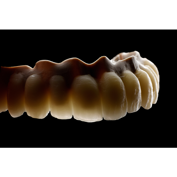 La arcada dentaria fijada sobre la estructura secundaria presentaba una translucidez expresiva.