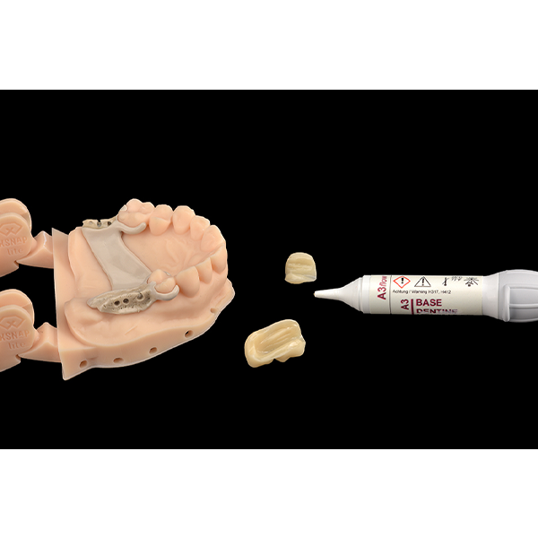 The cold-curing polymer resion VITA VM CC was used for cementation.