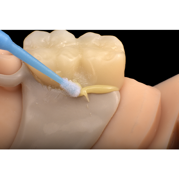 Removal of excess using the microbrush.