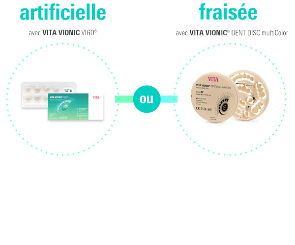 Digital Dentures : Choisissez la solution - VITA VIONIC Solutions.