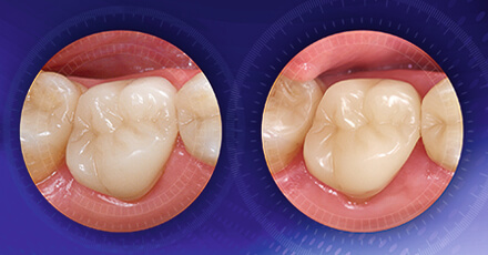 VITABLOCS®