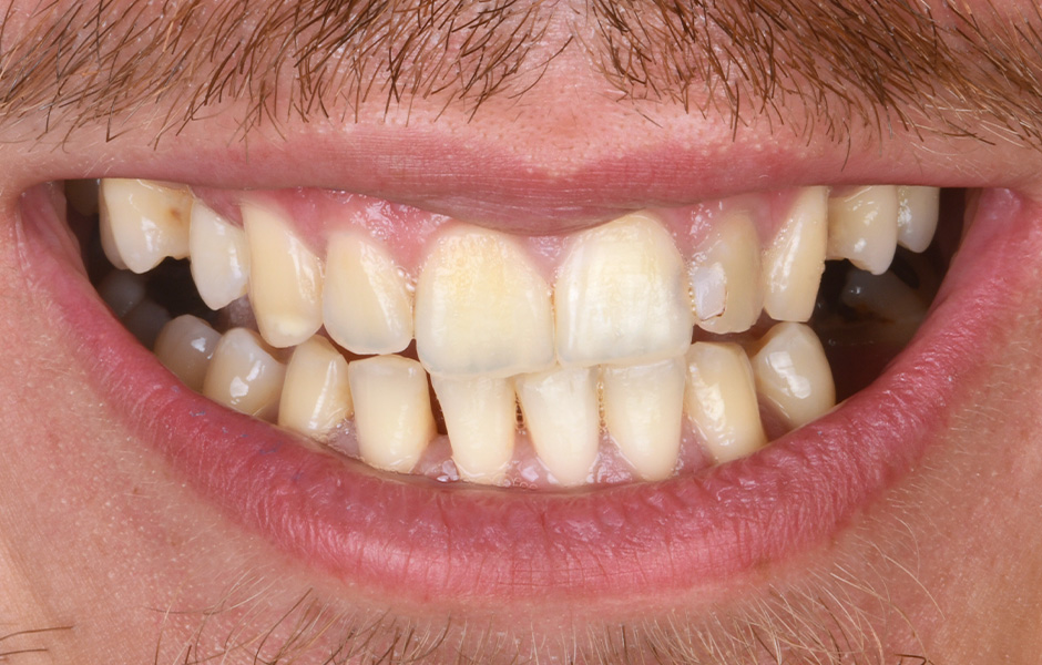 Le prothésiste dentaire Okke Kamps vérifie sur l'ordinateur le montage virtuel des dents