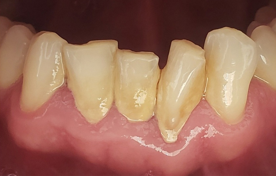 El protésico dental Okke Kamps comprueba en el ordenador el montaje virtual de los dientes.
